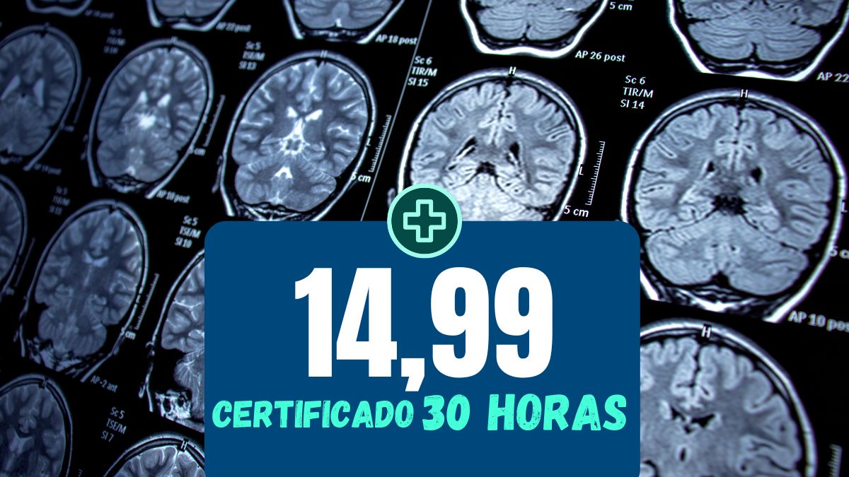 Imagem do curso Assistência de Enfermagem em Doenças Neurológicas