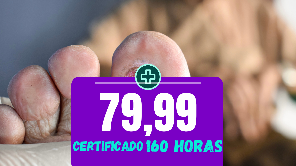 Imagem do curso Prevenção de Lesão Por Pressão (LPP)
